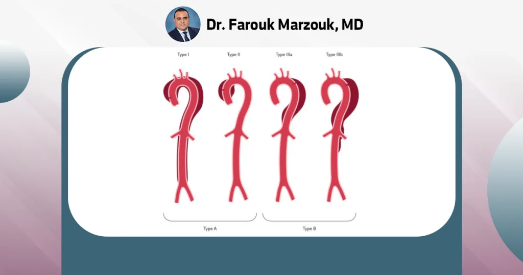 How do you know if you have an aneurysm in your groin area?