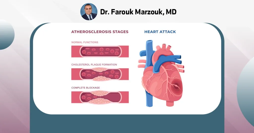 Blockage of the aorta | How serious is a blockage in the aorta? Blockage of the aorta | How serious is a blockage in the aorta?