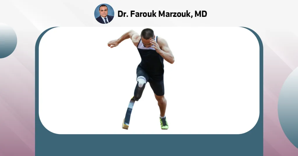 Through Knee Amputation Gritti-Stokes amputation
