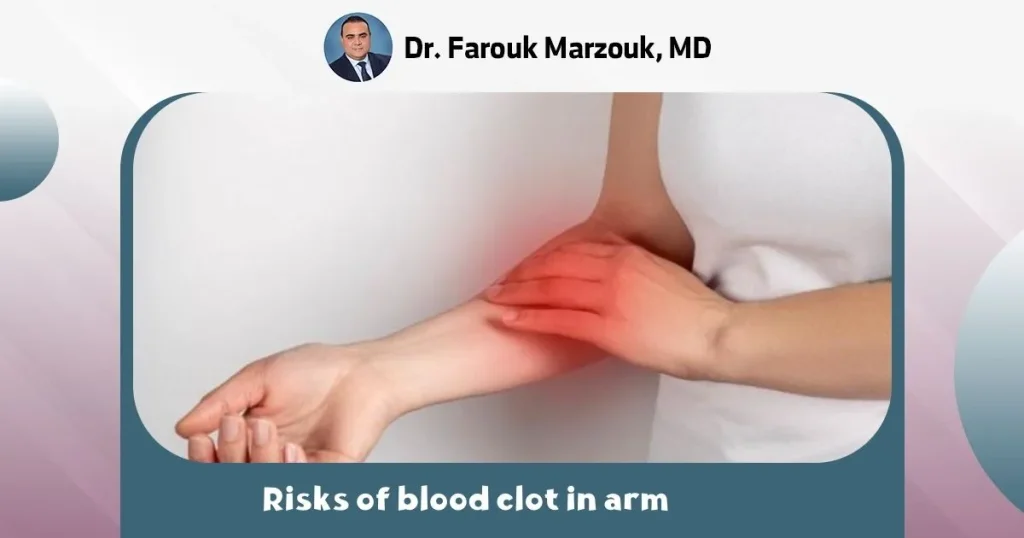 Risks of blood clot in arm