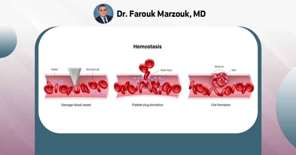 Vascular injuries | What are common vascular injuries? What are common vascular injuries?