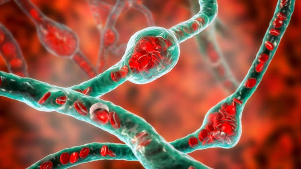 Hemangiomas: Causes, Symptoms