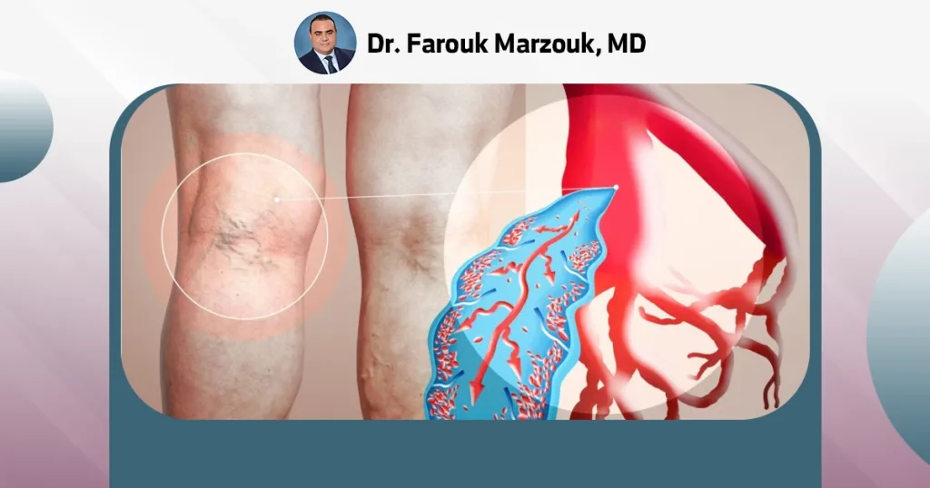 venous stents | How long do venous stents last? What is the difference between arterial and venous stents?