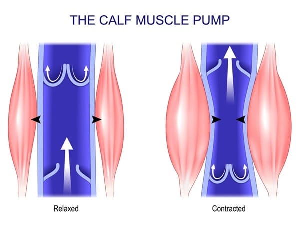 Peripheral vascular diseases | What is the most common peripheral vascular disease? Peripheral vascular diseases | Peripheral vascular disease examples