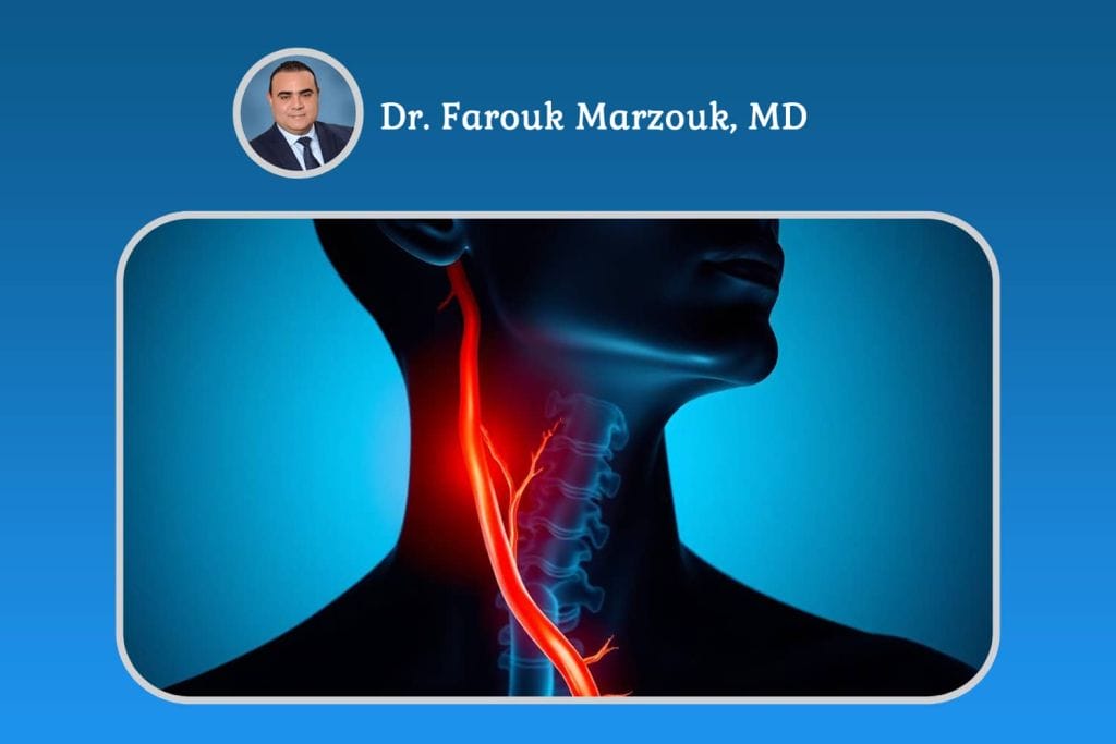 Blocked Artery in Neck: Symptoms and Treatment Blocked Artery in Neck: Symptoms and Treatment