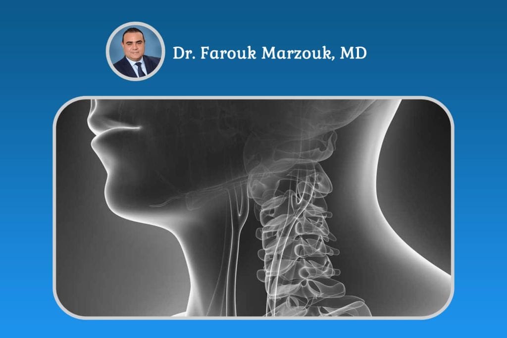 Carotid Stenosis Symptoms Carotid Stenosis Symptoms