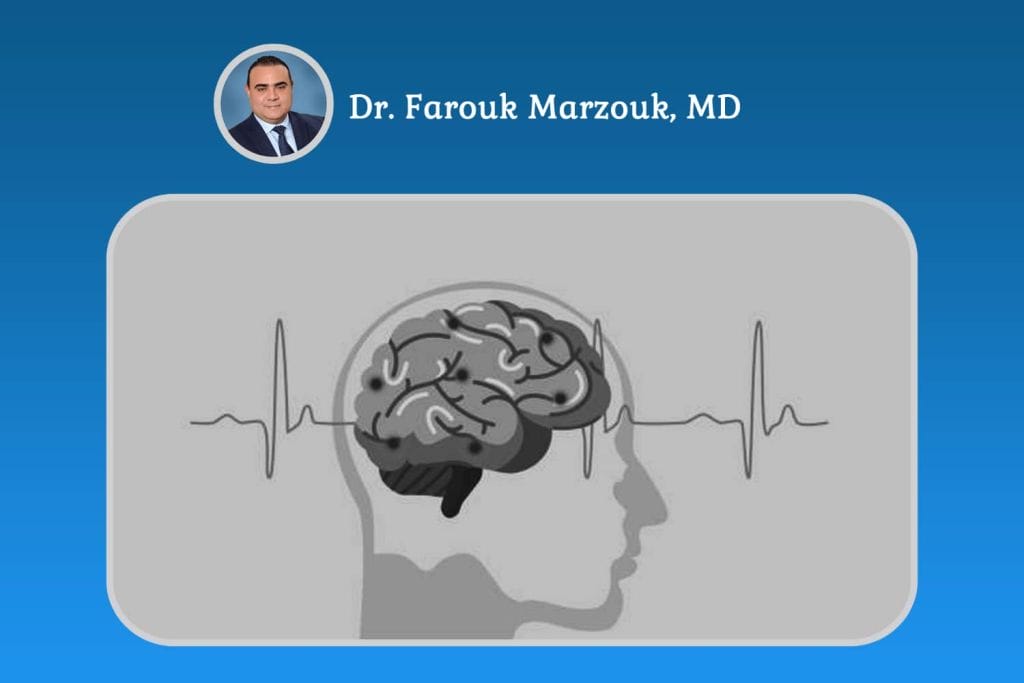 How to Stop a Stroke in Progress How to Stop a Stroke in Progress Critical Steps to Take