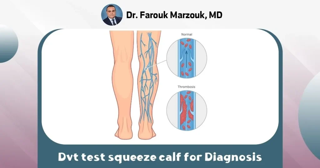 Dvt test squeeze calf for Diagnosis