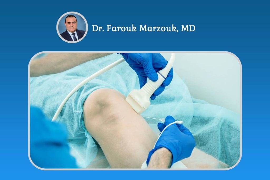 Long-Term Side Effects of Vein Ablation