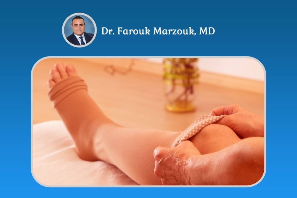 Side Effects of Wearing Compression Stockings