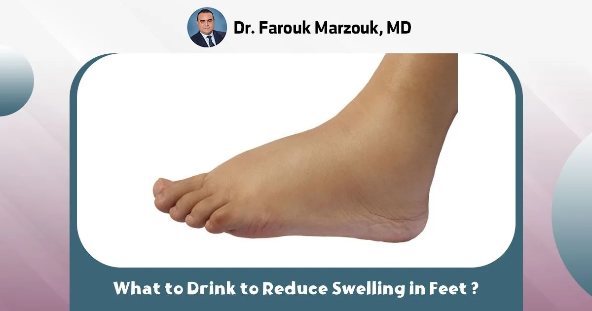 What to Drink to Reduce Swelling in Feet ?