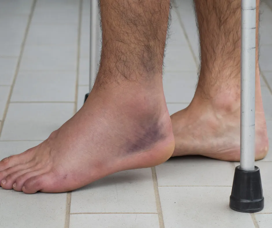 What to Drink to Reduce Swelling in Feet ? what drink is good for swollen legs
