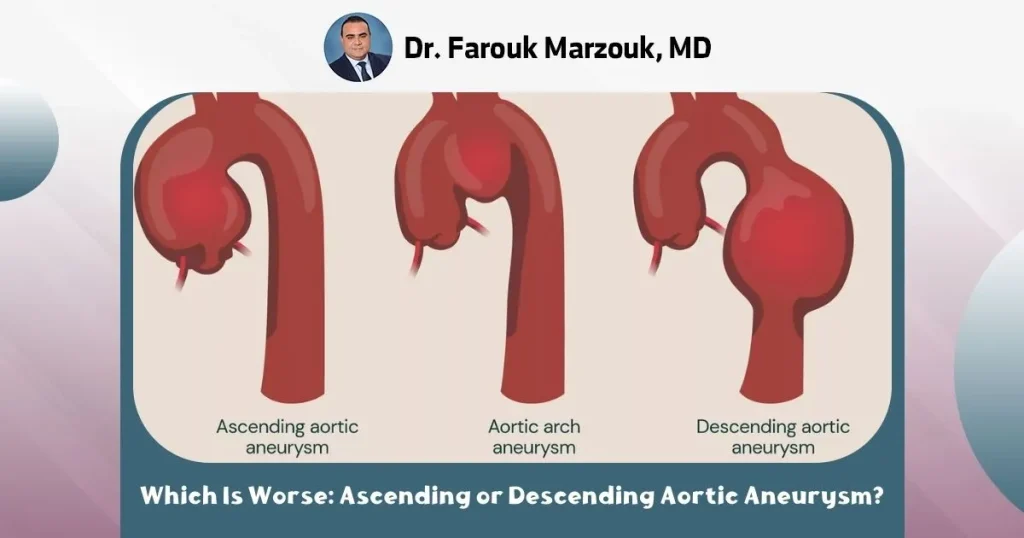 Which Is Worse Ascending or Descending Aortic Aneurysm