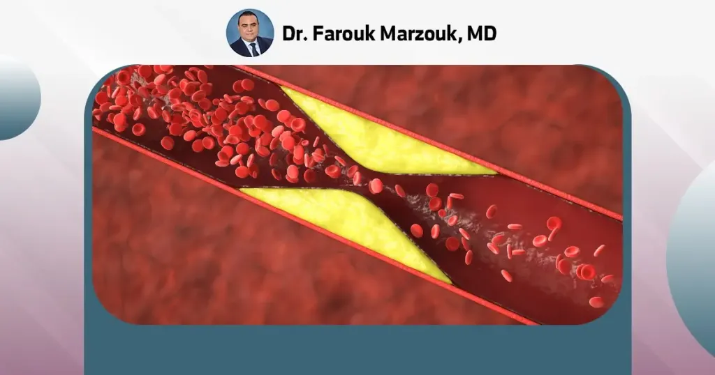 Hematoma Vs Blood Clot