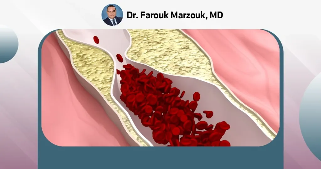 blocked artery in leg treatment without surgery