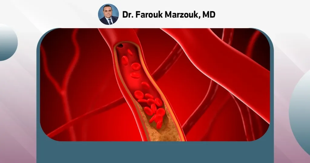 is peripheral arterial disease reversible