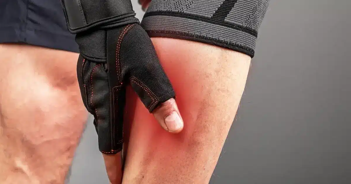 Preventive Measures DVT vs Calf Strain 