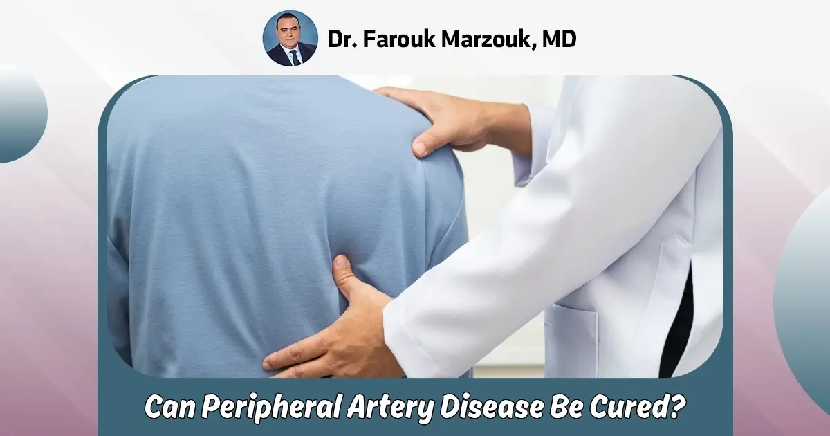 Can Peripheral Artery Disease Be Cured: Is PAD curable?