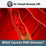 What Causes PAD Disease In Legs?